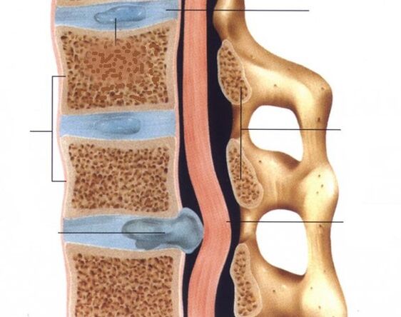 A hernia pronúnciase
