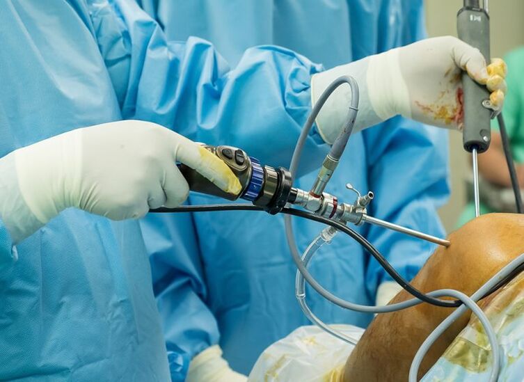 Artroscopia - operación para artrose da articulación do xeonllo