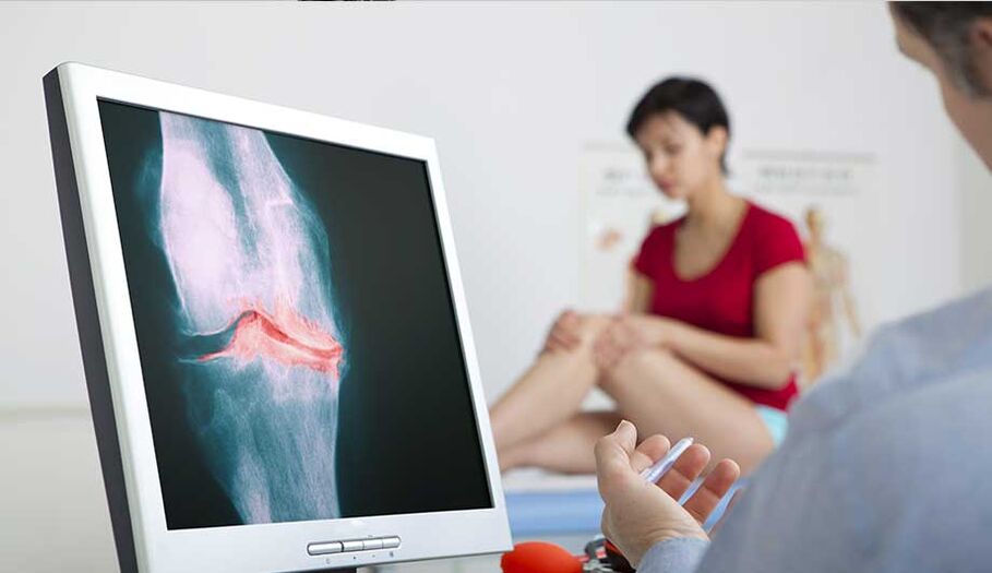Consulte a un médico se sospeita de artrite ou osteoartrite