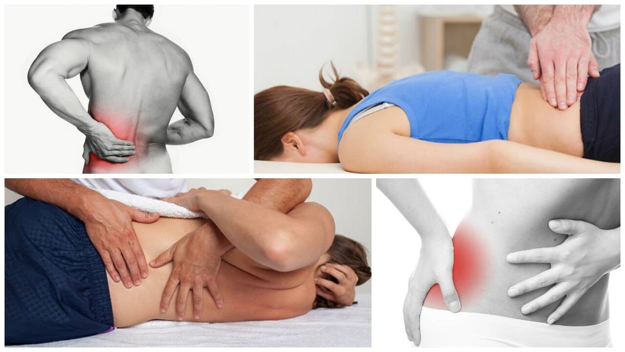 Síntomas e causas da dor nas costas