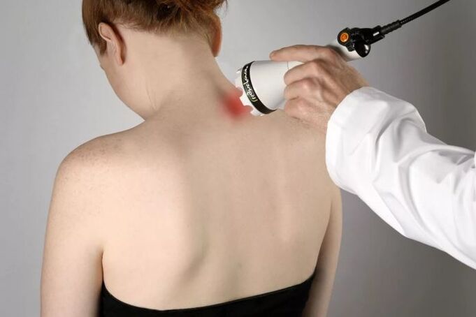 Fisioterapia para osteocondrose