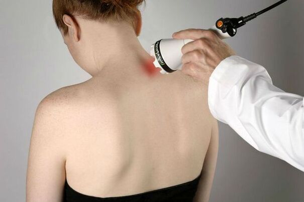 Medidas fisioterapéuticas para o tratamento da osteocondrose cervical