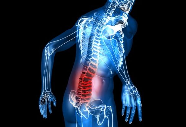 Que é a osteocondrose lumbar